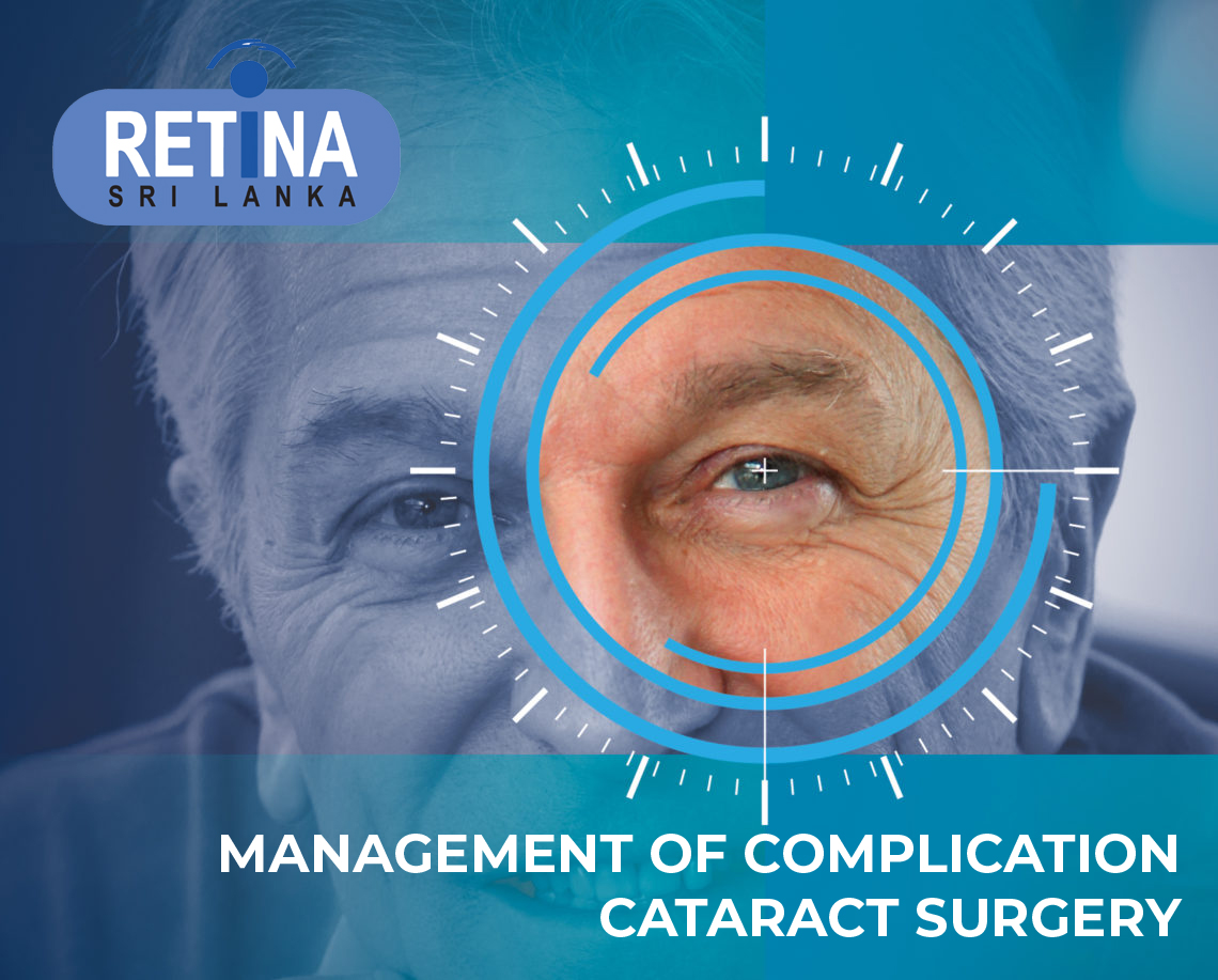 Workshop on Management of Complications in Cataract Surgery